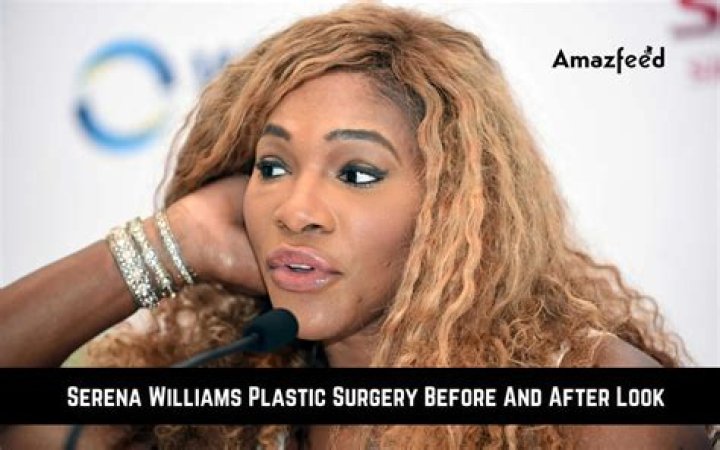 Ashley Williams Plastic Surgery: From Making Speculations to Disclosing Facts!