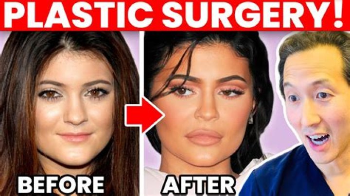 Dakota Fanning’s Plastic Surgery: Is It All Artificial Procedures or Adulting Gracefully?