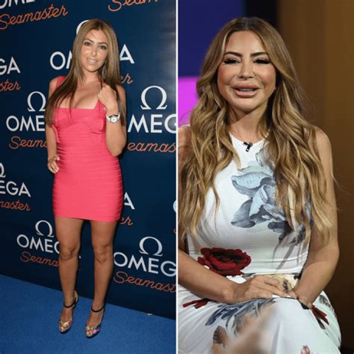 Larsa Pippen Before and After Surgery Pictures
