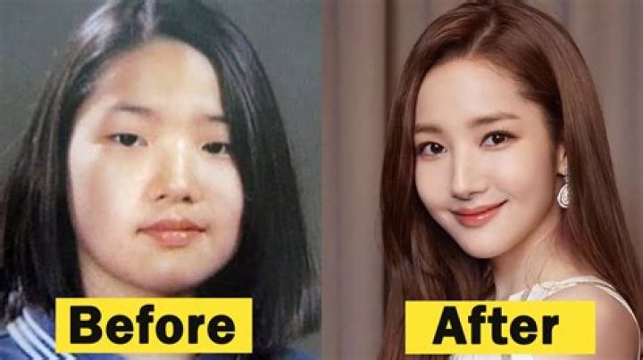 Lee Jae Wook Plastic Surgery: Exploring the Truth Behind Celebrity Speculations