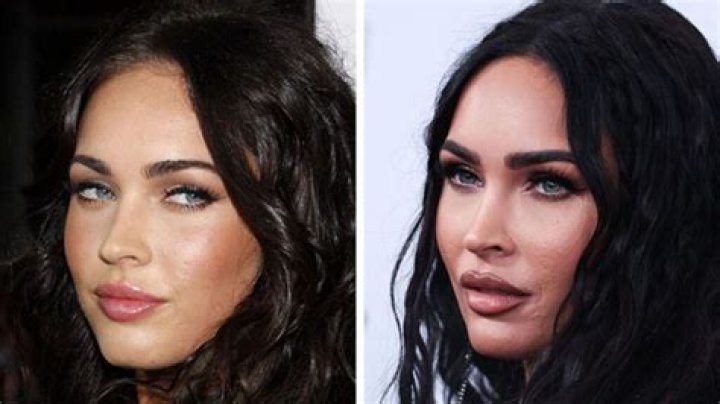 Megan Fox Plastic Surgery: How Her Cosmetic Procedures Transformed Her Appearance