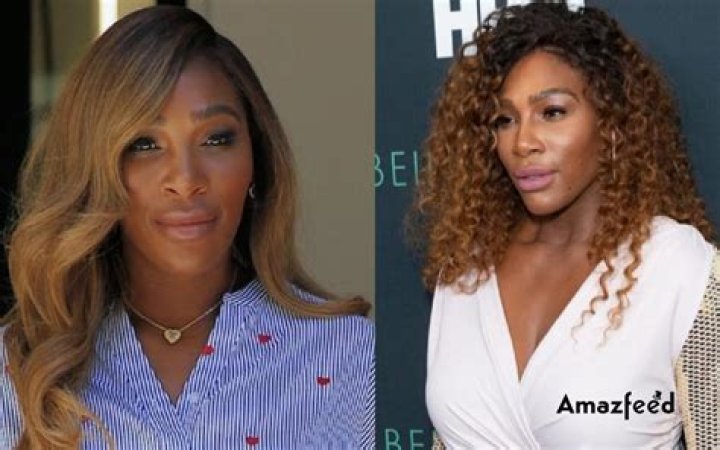 Serena Williams Plastic Surgery: Nose Job, Breast Implants, or Skin Whitening Treatment?